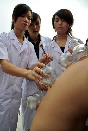 在廣西南寧市仙葫開發(fā)區(qū)一次中醫(yī)進(jìn)社區(qū)義診活動(dòng)中,來自中醫(yī)院校的學(xué)生在為居民進(jìn)行傳統(tǒng)中醫(yī)拔火罐治療(2010年10月14日攝)。新華社記者 陸波岸 攝